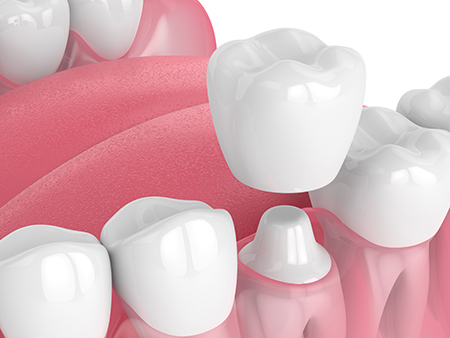 The Toothboss